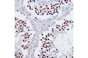 Immunohistochemistry of paraffin-embedded mouse testis using PPARD Rabbit pAb (ABIN6132423, ABIN6146002, ABIN6146003 and ABIN6221300) at dilution of 1:50 (40x lens). (PPARD antibody  (AA 102-361))