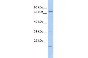 WB Suggested Anti-FUBP3 Antibody Titration: 0. (FUBP3 antibody  (N-Term))