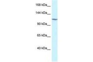 Image no. 1 for anti-Protein Kinase N2 (PKN2) (AA 605-654) antibody (ABIN6747330) (PKN2 antibody  (AA 605-654))