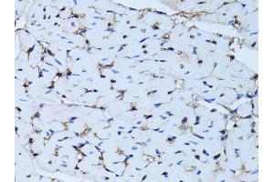 Immunohistochemistry of paraffin-embedded mouse heart using FABP4 antibody (ABIN5970061) at dilution of 1/100 (40x lens). (FABP4 antibody)