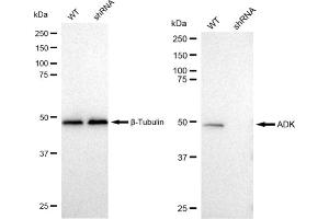 Western blotting analysis using ADK antibody (ABIN7797517).