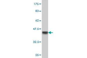 Western Blot detection against Immunogen (37. (RBBP6 antibody  (AA 1582-1691))