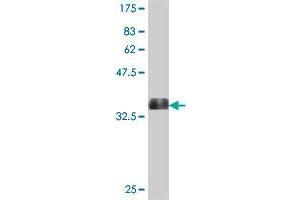 Western Blot detection against Immunogen (36. (OSBPL5 antibody  (AA 4-99))