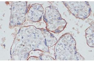 Immunohistochemistry (Paraffin-embedded Sections) (IHC (p)) image for anti-Transferrin Receptor (p90, CD71) (TFRC) antibody (ABIN7261824)