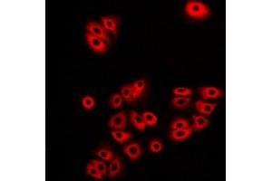 Immunofluorescent analysis of Atlastin-1 staining in A549 cells. (ATL1 antibody)