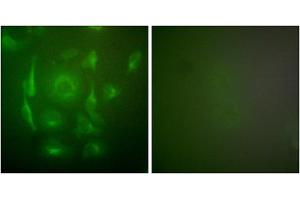Immunofluorescence analysis of HepG2 cells, using Keratin 7 antibody (ABIN5976442). (Cytokeratin 7 antibody  (C-Term))