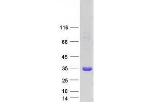 Validation with Western Blot (CHAC1 Protein (Transcript Variant 1) (Myc-DYKDDDDK Tag))