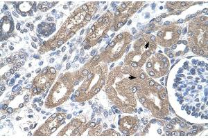 Immunohistochemistry (IHC) image for anti-Tryptophan 2,3-Dioxygenase (TDO2) (N-Term) antibody (ABIN2782334) (TDO2 antibody  (N-Term))