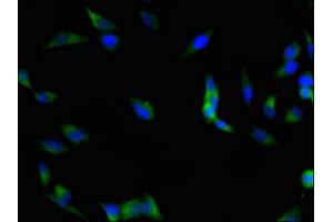 Immunofluorescent analysis of Hela cells using ABIN7152982 at dilution of 1:100 and Alexa Fluor 488-congugated AffiniPure Goat Anti-Rabbit IgG(H+L) (FAK antibody  (AA 363-464))
