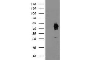 HEK293T cells were transfected with the pCMV6-ENTRY control (Left lane) or pCMV6-ENTRY ASCC1 (Right lane) cDNA for 48 hrs and lysed. (ASCC1 antibody)