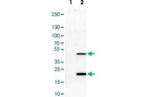 Western Blot analysis of Lane 1: negative control (vector only transfected HEK293T cell lysate) and Lane 2: over-expression lysate (co-expressed with a C-terminal myc-DDK tag in mammalian HEK293T cells) with ASRGL1 monoclonal antibody, clone CL1679 . (ASRGL1 antibody)