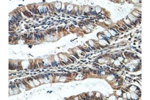 Immunohistochemical staining of formalin-fixed paraffin-embedded human fetal small intestine tissue showing cytoplasmic staining with NUDT7 polyclonal antibody  at 1 : 100 dilution. (NUDT7 antibody  (AA 2-236))