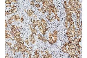 IHC analysis of CDK5 using anti-CDK5 antibody (ABIN6719393).