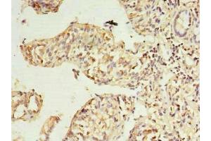 Immunohistochemistry of paraffin-embedded human small intestine tissue using ABIN7168501 at dilution of 1:100