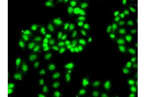 Immunofluorescence analysis of A549 cells using HNRNPA1 antibody. (HNRNPA1 antibody)