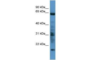 WB Suggested Anti-GRK7 Antibody Titration: 0.
