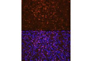 Immunofluorescence analysis of human spleen cells using Lipocalin-2/NGAL Rabbit pAb (ABIN3022890, ABIN3022891, ABIN3022892 and ABIN6219282) at dilution of 1:100 (40x lens). (Lipocalin 2 antibody  (AA 21-198))
