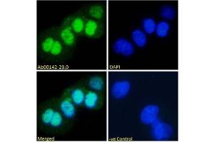 Immunofluorescence staining of fixed A431 with anti-p53 antibody (ABIN5668085) Immunofluorescence analysis of paraformaldehyde fixed A431 cells, permeabilized with 0. (Recombinant p53 antibody  (AA 371-380))