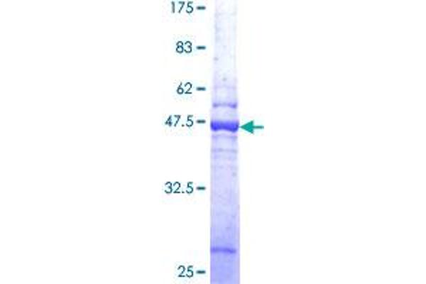 AP3S1 Protein (AA 1-193) (GST tag)