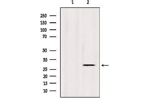 Western blot analysis of extracts from Sp2/0, using INSIG1 Antibody. (INSIG1 antibody  (Internal Region))