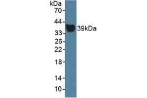 Detection of Hpt in Rat Serum using Polyclonal Antibody to Haptoglobin (Hpt) (Haptoglobin antibody  (AA 70-332))