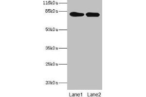 Western blot All lanes: LHCGR antibody at 2 μg/mL Lane 1: Mouse brain tissue Lane 2: Mouse kidney tissue Secondary Goat polyclonal to rabbit IgG at 1/10000 dilution Predicted band size: 79, 72 kDa Observed band size: 79 kDa (LHCGR antibody  (AA 27-363))