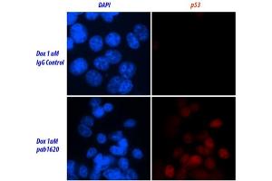 Image no. 2 for anti-Tumor Protein P53 (TP53) (Wild Type) antibody (ABIN2704419) (p53 antibody  (Wild Type))