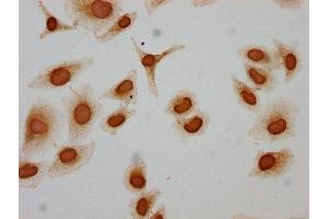 Immunocytochemistry (ICC) image for anti-Histone Cluster 1, H3a (HIST1H3A) (acLys122) antibody (ABIN7139156)
