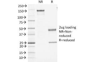 SDS-PAGE Analysis Purified CD45 Monoclonal Antibody (PTPRC/1461). (CD45 antibody)