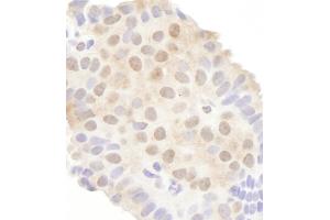 anti-DEAD (Asp-Glu-Ala-Asp) Box Polypeptide 20 (DDX20) (AA 600-650) antibody
