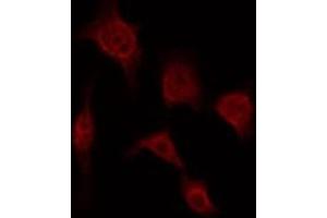 ABIN6268764 staining MCF7 by IF/ICC. (Claudin 5 antibody)