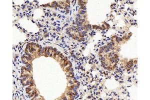 Immunohistochemistry analysis of paraffin-embedded mouse lung using IL22RA1 Polyclonal Antibody at dilution of 1:200. (IL22 Receptor alpha 1 antibody)