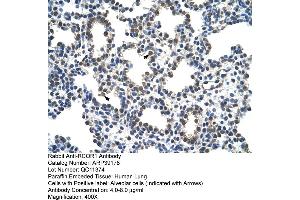 Human Lung (CoREST antibody  (N-Term))