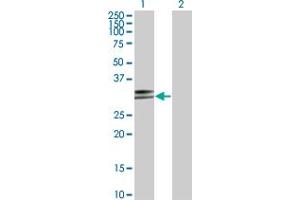 Western Blot analysis of HLA-DPA1 expression in transfected 293T cell line by HLA-DPA1 monoclonal antibody (M03), clone 1E3.