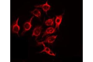 ABIN6275707 staining Hela by IF/ICC. (ZNHIT6 antibody  (Internal Region))