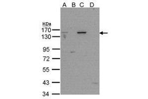 Image no. 1 for anti-Poly (ADP-Ribose) Polymerase 1 (PARP1) (AA 151-385) antibody (ABIN467410) (PARP1 antibody  (AA 151-385))