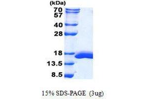 Figure annotation denotes ug of protein loaded and % gel used. (Galectin 2 Protein)