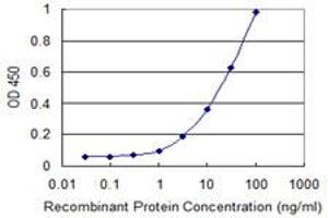 Detection limit for recombinant GST tagged RCC1 is 0. (RCC1 antibody  (AA 312-421))