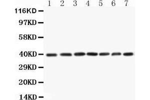 Western Blotting (WB) image for anti-Mitogen-Activated Protein Kinase Kinase 3 (MAP2K3) (AA 320-334), (C-Term) antibody (ABIN3044392) (MAP2K3 antibody  (C-Term))