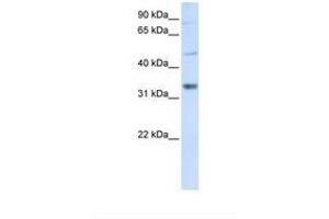 Image no. 1 for anti-Zinc Finger, CCHC Domain Containing 17 (ZCCHC17) (AA 146-195) antibody (ABIN6737801) (ZCCHC17 antibody  (AA 146-195))