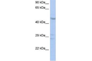 WB Suggested Anti-ACPL2 Antibody Titration:  0. (ACPL2 antibody  (Middle Region))