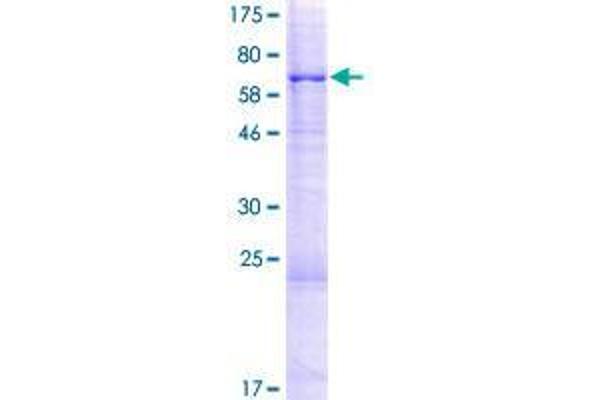 CRISPLD2 Protein (AA 1-449) (GST tag)