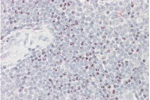 Immunohistochemistry (IHC) image for anti-Large Proline-Rich Protein BAT3 (BAT3) antibody (ABIN5926991) (BAT3 antibody)