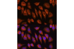 Immunofluorescence analysis of L929 cells using GOLG Rabbit pAb (ABIN6129790, ABIN6141266, ABIN6141267 and ABIN6214379) at dilution of 1:100 (40x lens). (GOLGA4 antibody  (AA 1-150))