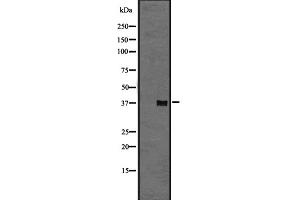 Western blot analysis of GPR6 expression in A431 whole cell lysate ,The lane on the left is treated with the antigen-specific peptide. (GPR6 antibody  (Internal Region))