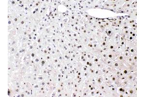 HMGB1 was detected in paraffin-embedded sections of mouse liver tissues using rabbit anti- HMGB1 Antigen Affinity purified polyclonal antibody (Catalog # ) at 1 µg/mL. (HMGB1 antibody  (C-Term))