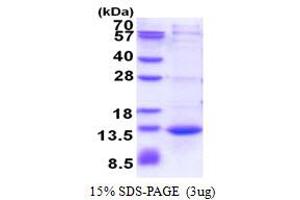 Calcium/calmodulin-Dependent Protein Kinase II Inhibitor 1 (CAMK2N1) (AA 1-78) protein (His tag)