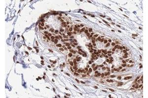 ABIN6268811 at 1/100 staining human Breast tissue sections by IHC-P.