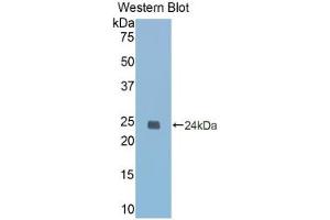 Western blot analysis of the recombinant protein. (Caspase 1 antibody  (AA 119-296))