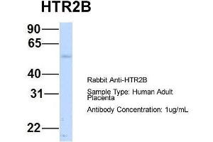 Host:  Rabbit  Target Name:  HTR2B  Sample Type:  Human Adult Placenta  Antibody Dilution:  1. (Serotonin Receptor 2B antibody  (N-Term))